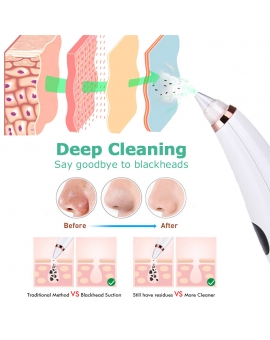 7-in-1 Blackhead Vacuum Remover