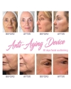 Facial Anti-Aging Toning Device